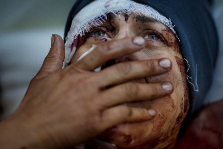 A woman named Aida cries as she recovers from severe injuries after the Syrian army shelled her house in Idlib, northern Syria, March 10, 2012. Aida's husband and two children were killed in the attack.   Photo by Rodrigo Abd